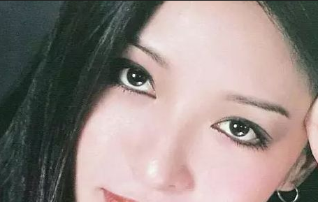 割雙眼皮會(huì)反彈嗎？