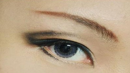 疤痕皮膚可以割雙眼皮嗎？40歲做埋線雙眼皮的效果好不好？