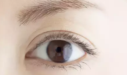 做雙眼皮的效果如何？