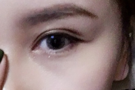 做雙眼皮對(duì)眼睛視力有影響嗎？雙眼皮對(duì)身體有沒有危害？