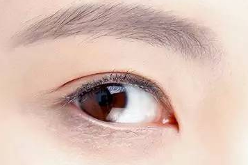開內(nèi)眼角大概多少錢？開內(nèi)眼角大概需要多久恢復(fù)？