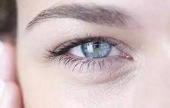 開內(nèi)眼角的弊端有哪些？