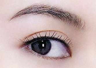 開內眼角的恢復期是多久？開內眼角的弊端有哪些？