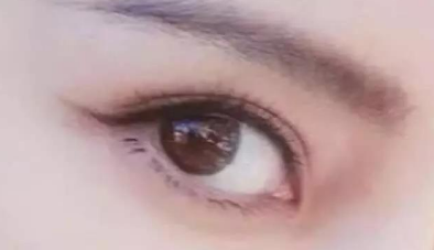 開眼角多久可以完全恢復？
