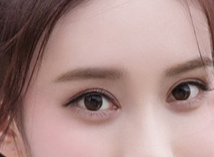 開(kāi)眼角一般需要多少錢？