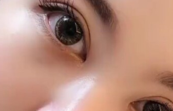 開眼角有沒有風險？開眼角有沒有副作用？