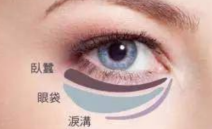激光能祛除眼袋嗎？