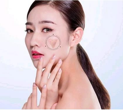 深圳好的祛痘整形醫(yī)院有哪家？名單值得收藏！
