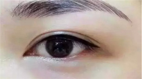 昆山雙眼皮整形醫(yī)院哪幾家好？實力口碑醫(yī)院推薦！