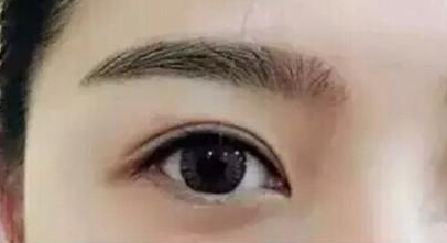 廈門眼部整形醫(yī)院排名榜盤點(diǎn)！10家正規(guī)機(jī)構(gòu)供你挑選！