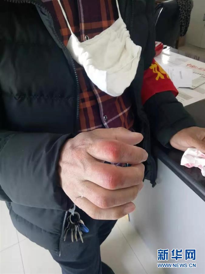 （在習(xí)近平新時代中國特色社會主義思想指引下&mdash;&mdash;新時代新作為新篇章&middot;習(xí)近平總書記關(guān)切事&middot;圖文互動）（2）戰(zhàn)&ldquo;疫&rdquo;中的&ldquo;凡人微光&rdquo;