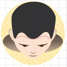 二級脫發(fā)