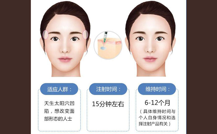 玻尿酸豐太陽(yáng)穴一般幾支？