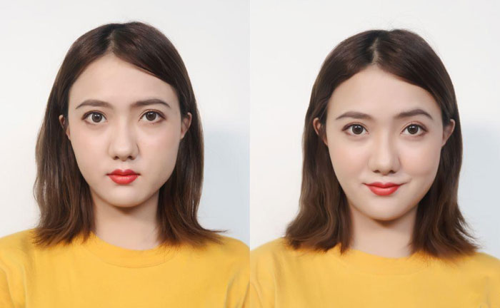 大小臉是什么原因造成的？大小臉怎么辦怎么矯正？
