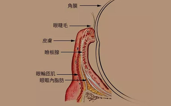 眼瞼內(nèi)翻手術(shù)成功率多少?眼瞼內(nèi)翻手術(shù)后遺癥有哪些?
