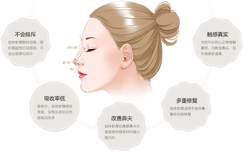 自體軟骨隆鼻可以永久的嗎？