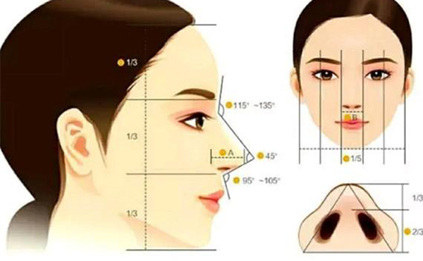 假體隆鼻恢復(fù)期要多長時間？假體隆鼻不滿意還能做注射隆鼻改善嗎？