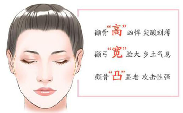顴骨內(nèi)推整形適宜人群？