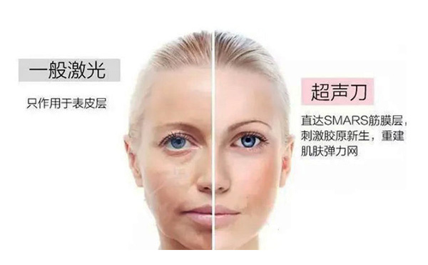 超聲刀有什么優(yōu)勢？