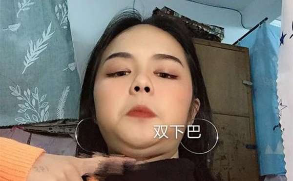 吸脂去雙下巴和溶脂瘦下巴有什么區(qū)別？