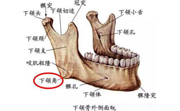 下頜角肥大應(yīng)該怎么辦呢?