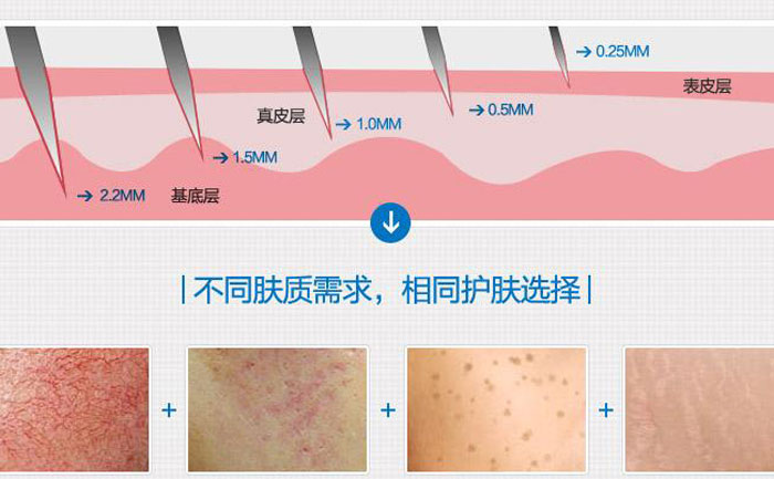 微針去痘坑多少錢(qián)一次？