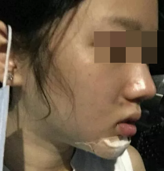 輪廓立體，更自信