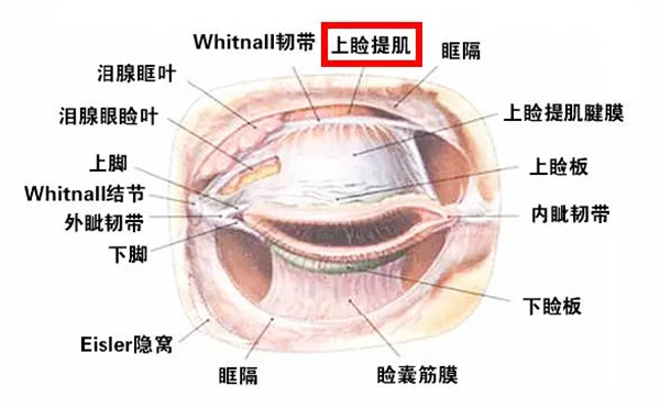 上瞼下垂手術成功率高嗎?上瞼下垂術后需要注意什么?