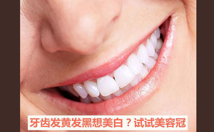 牙齒美容冠大約多少錢？牙齒美容冠怎么做的？