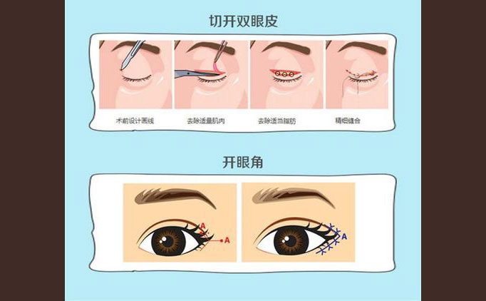 眼部修復(fù)手術(shù)包括什么項(xiàng)目？