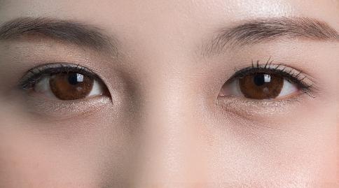 上眼皮松弛是什么原因引起的？