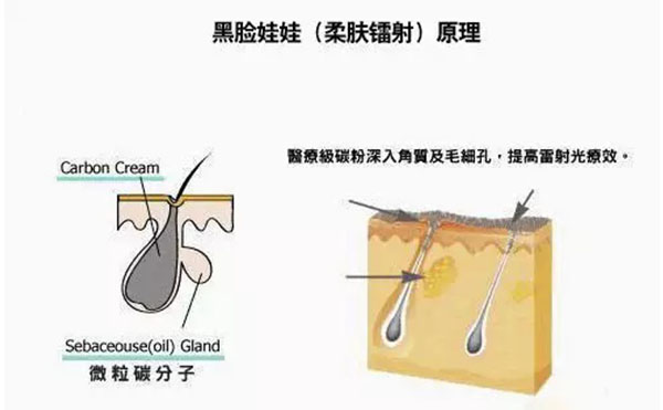 黑臉娃娃是什么？