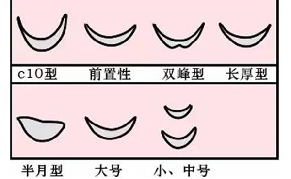 墊下巴整形多少錢?墊下巴手術(shù)的價格受什么因素影響?
