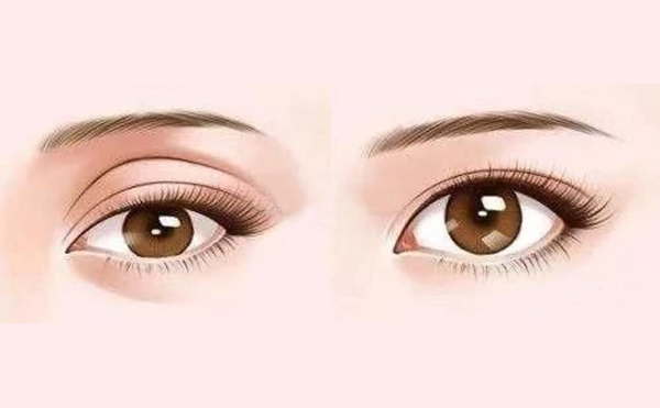 年輕人眼窩凹陷是什么原因?年輕人眼窩凹陷怎樣恢復?