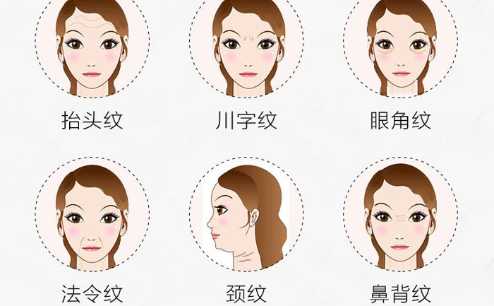 botox除皺針有哪些副作用？