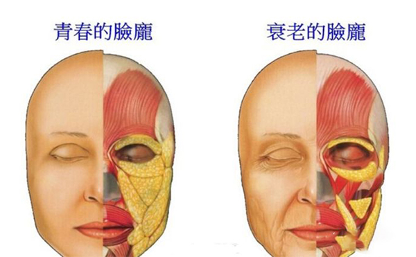 電波拉皮的誤區(qū)？