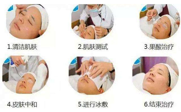 果酸煥膚的過程是什么？