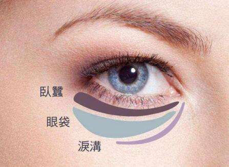 眼袋失敗修復(fù)要怎么處理？切眼袋需要多長(zhǎng)時(shí)間恢復(fù)？