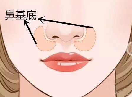 做玻尿酸墊鼻基底風(fēng)險(xiǎn)有哪些？深圳市玻尿酸豐鼻基底大概需要費(fèi)用？