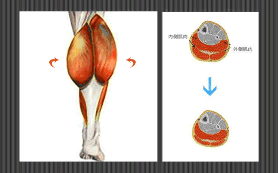 小腿肌肉阻斷術是什么？小腿神經(jīng)阻斷術的后遺癥有嗎？