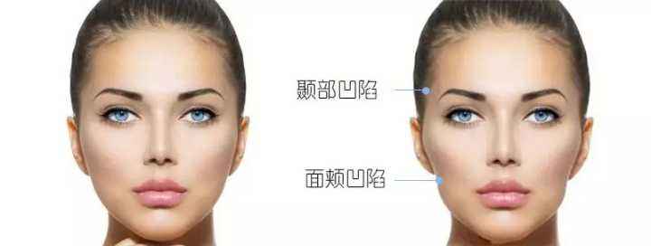 熱瑪吉做一次可以保持多久？熱瑪吉的原理和功效