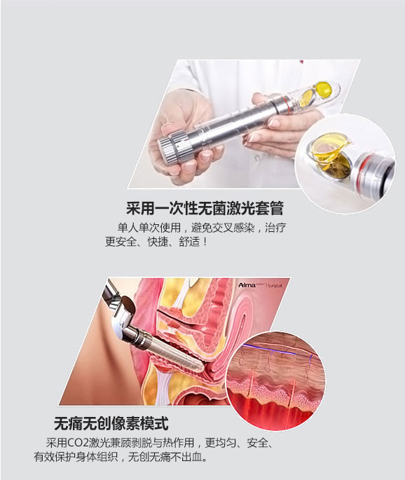 成都愛爾麗整形激光緊縮陰道怎么樣？激光緊縮陰道注意什么？