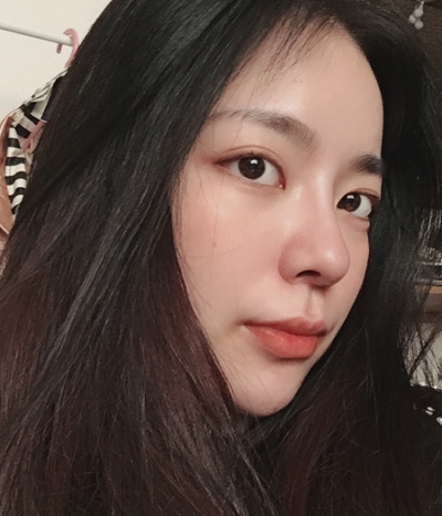成都漢密爾頓美容醫(yī)院做鼻修復術后的日常情況