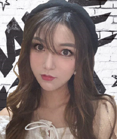寧波尚美整形美容醫(yī)院做隆鼻手術的最終效果