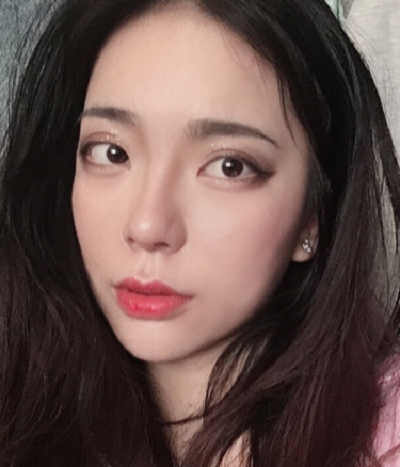 成都漢密爾頓美容醫(yī)院做鼻修復手術后的最終效果