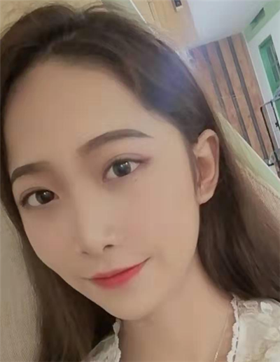 蘇州美貝爾美容醫(yī)院做面部吸脂手術(shù)后日常恢復效果