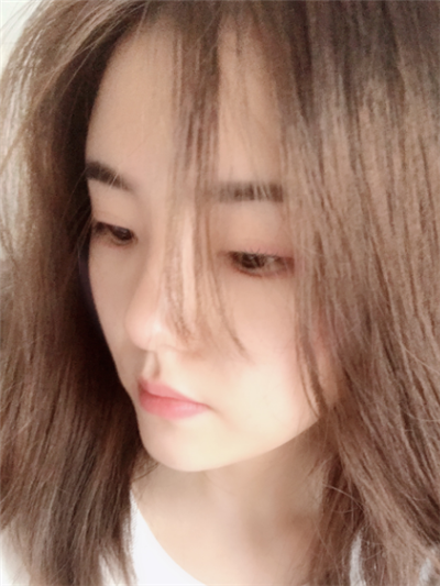 煙臺壹美整形美容醫(yī)院做隆鼻完成后的日常效果