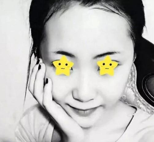 做綜合鼻，上海首爾麗格安建榮鼻綜合真人案例照片