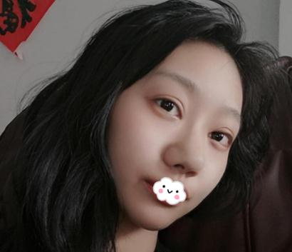 上海伊美爾港華做的3w的鼻子，你們說值不值