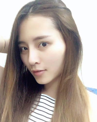 深圳微姿醫(yī)療美容門診部做鼻綜合手術(shù)后的日?；謴?fù)